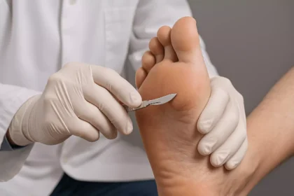 Home Remedies and Professional Treatments a Podiatrist Recommends