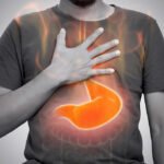 How Ulcerative Colitis Affects the Large Intestine and How It’s Treated