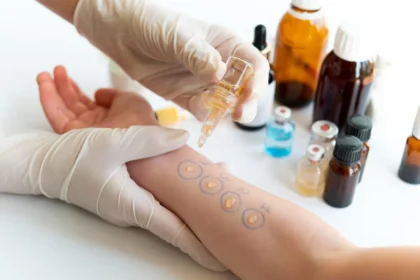 How Allergy Testing Can Identify Triggers
