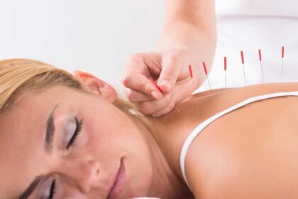 How To Prepare for Your First Acupuncture Visit