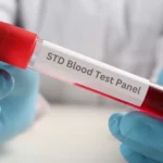 Understanding Your Rights and Responsibilities in STD Screenings