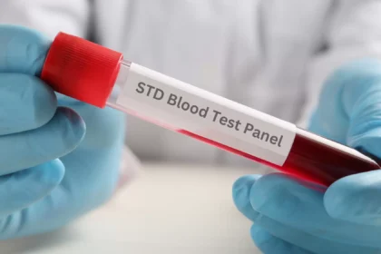 Understanding Your Rights and Responsibilities in STD Screenings