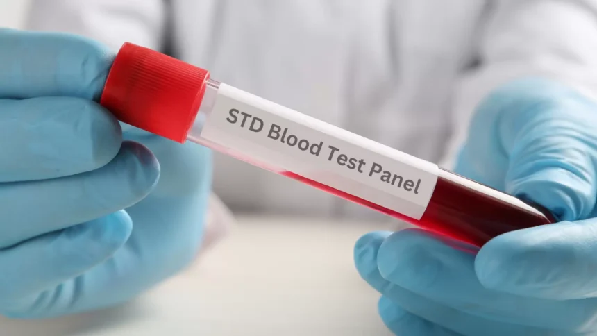 Understanding Your Rights and Responsibilities in STD Screenings